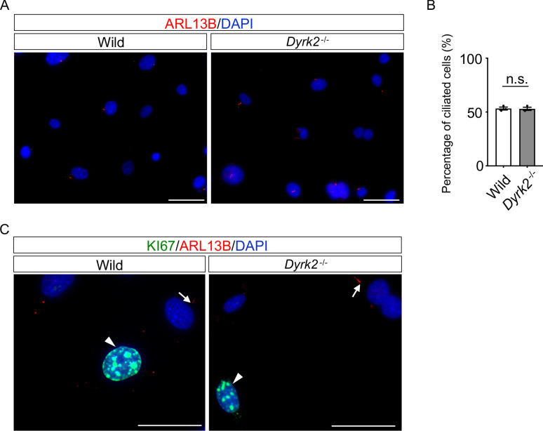 Figure 4—figure supplement 3.