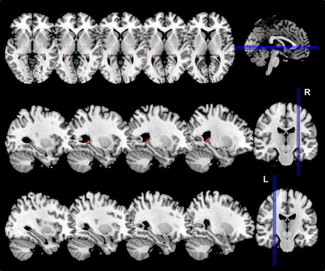 Figure 2