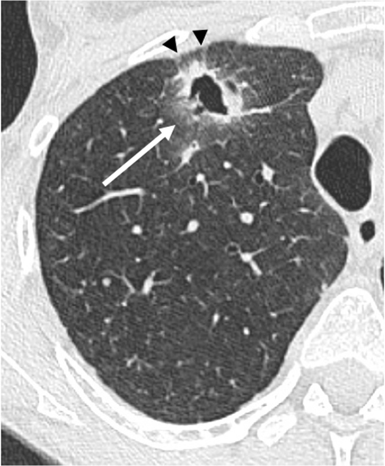 Fig. 20