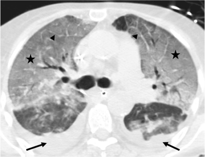 Fig. 13