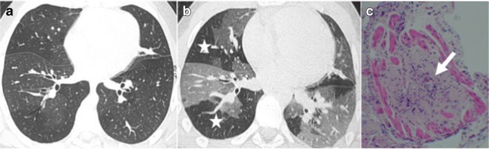 Fig. 11