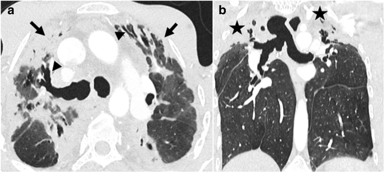 Fig. 12