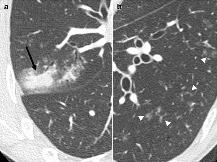Fig. 18