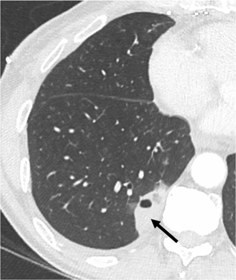 Fig. 16