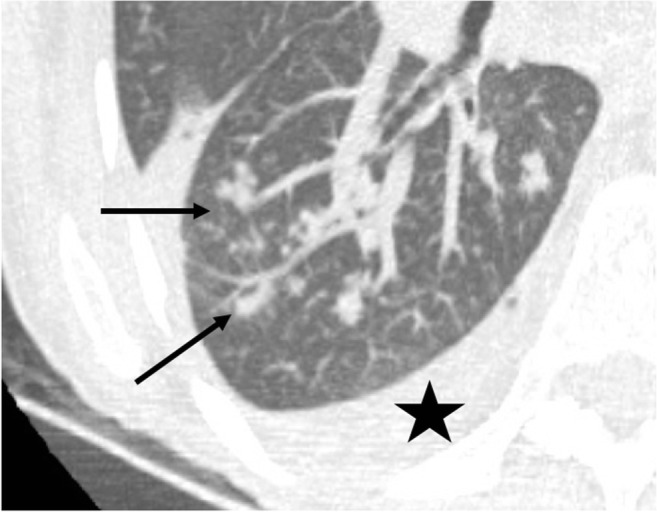 Fig. 14