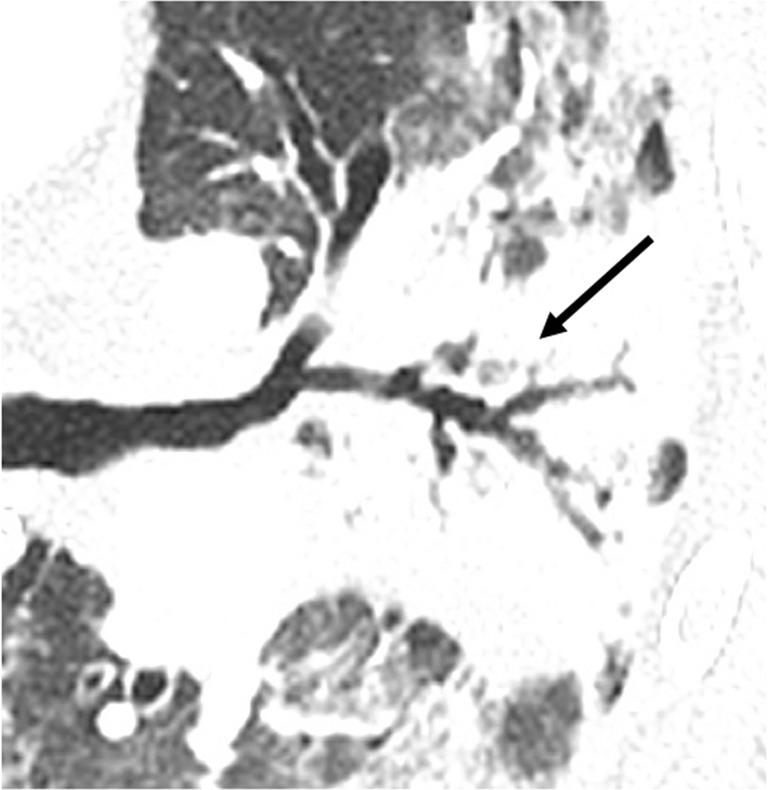Fig. 15