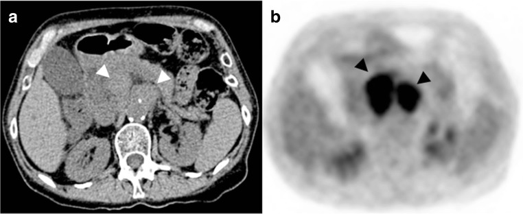 Fig. 19