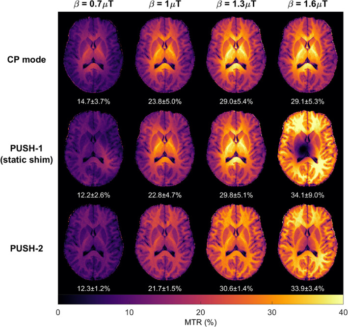 MRM-29199-FIG-0006-c