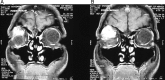 Figure 2: