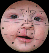 Fig. 1.