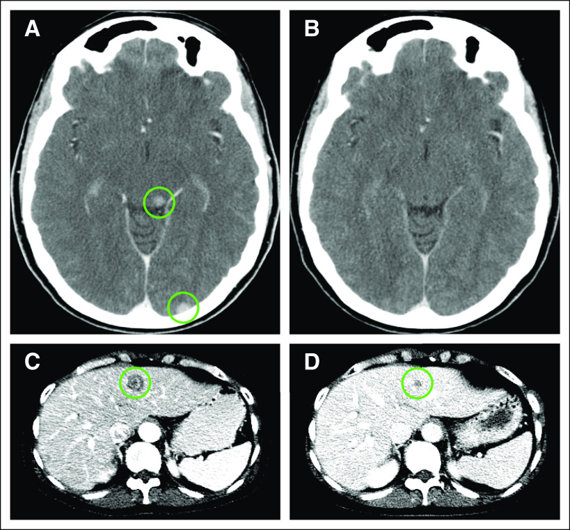 FIG 4.