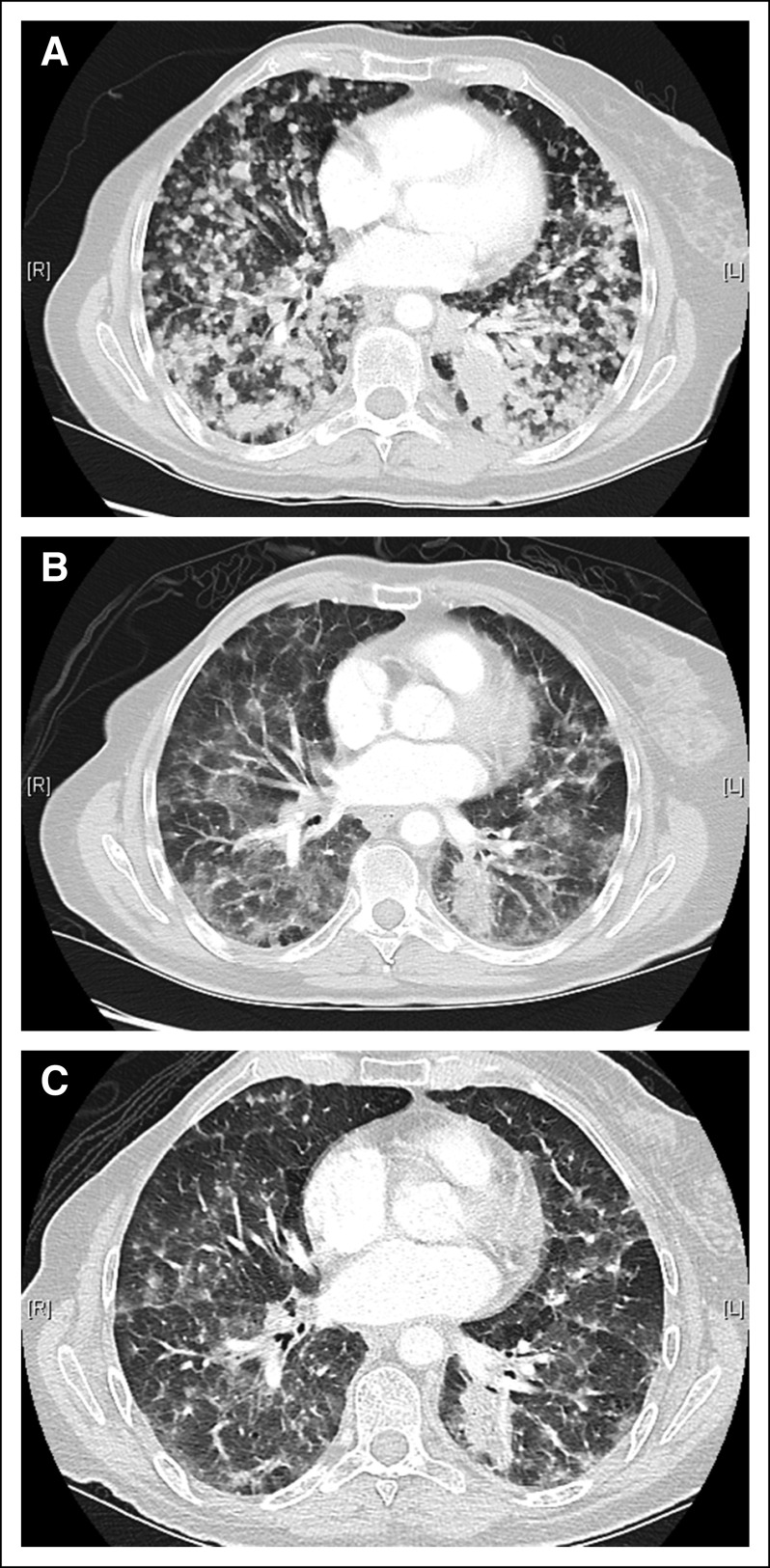 FIG 2.