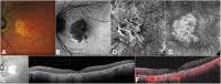 Fig. 1