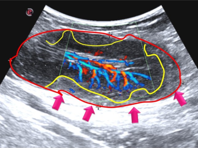 Fig. 2