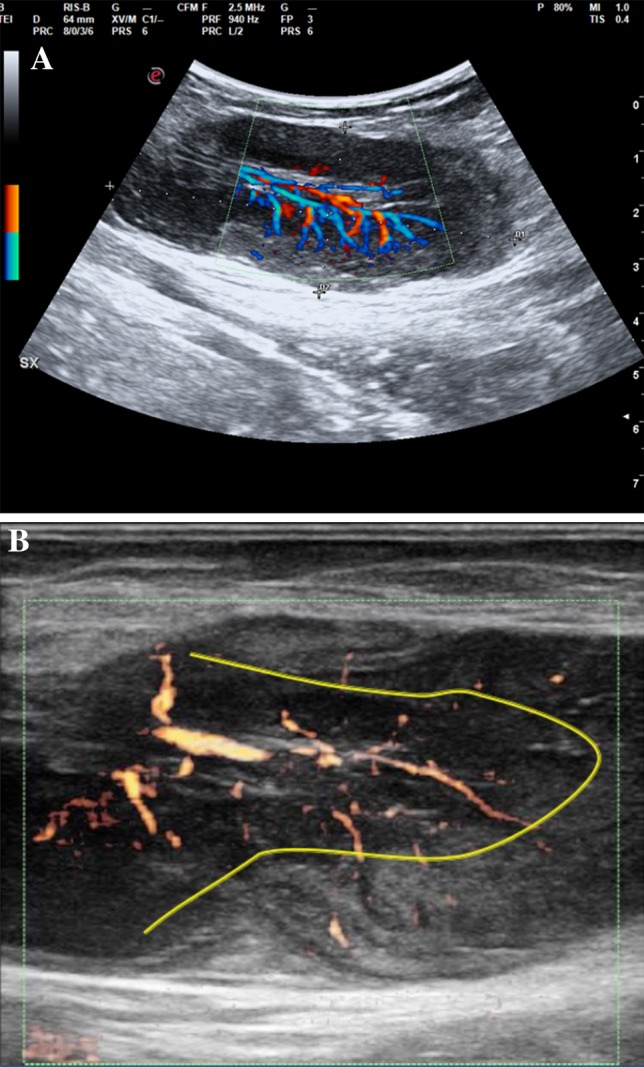 Fig. 1