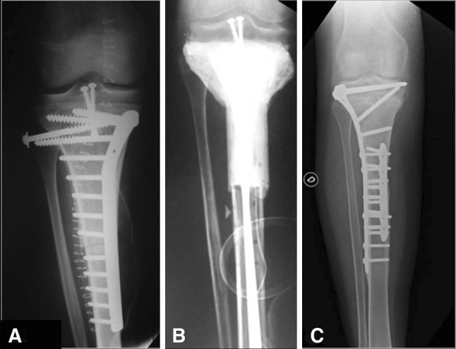 Fig. 4A–C