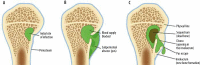 Figure 22