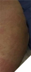 Figure 20