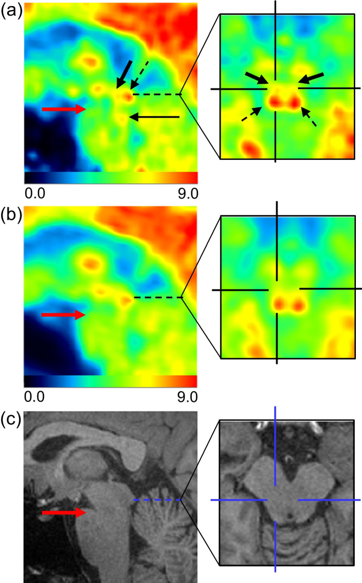 Fig. 4