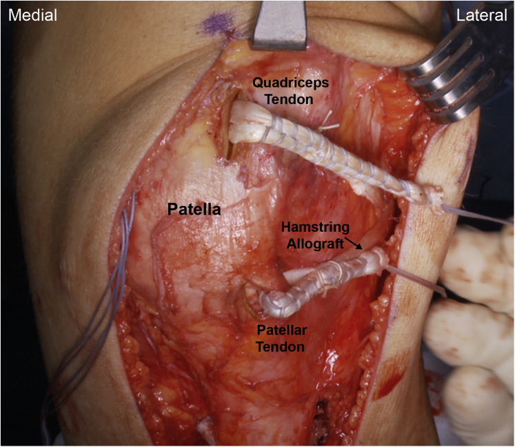 Fig 6