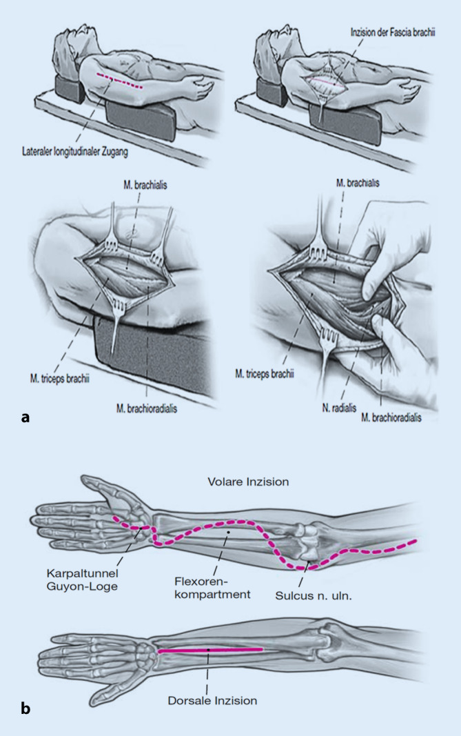 graphic file with name 104_2022_1624_Fig6_HTML.jpg