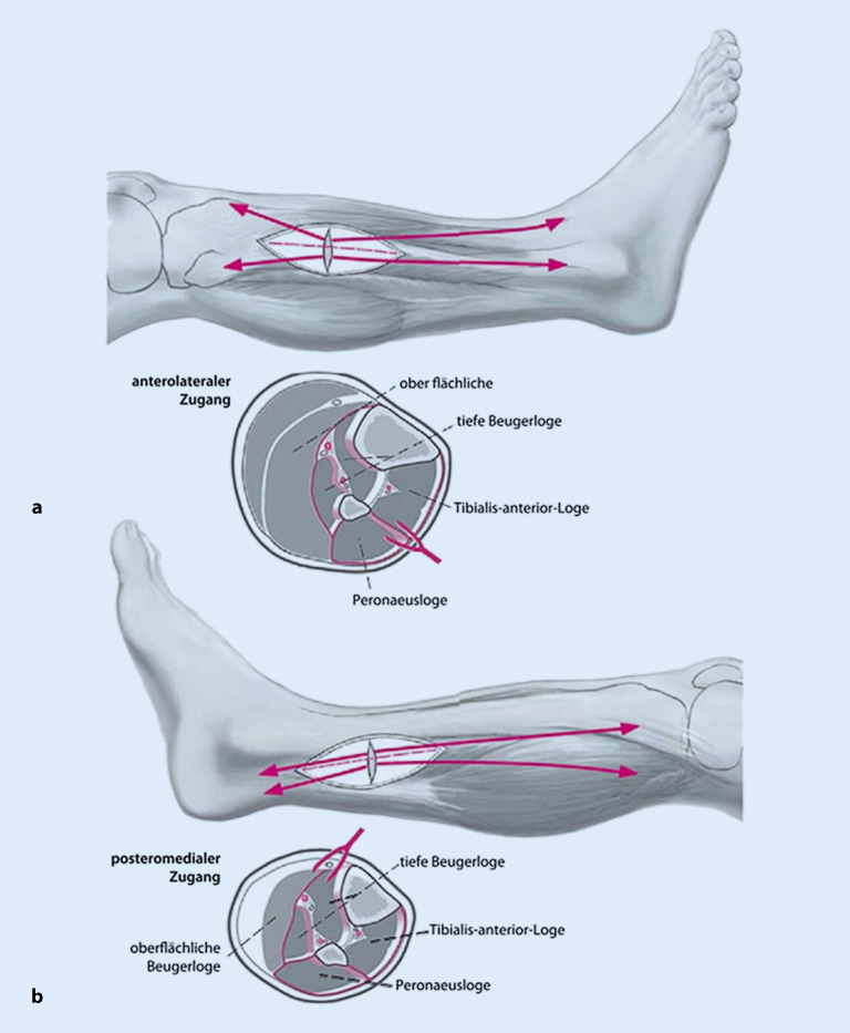 graphic file with name 104_2022_1624_Fig2_HTML.jpg