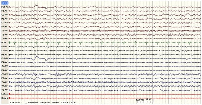 Figure 3.