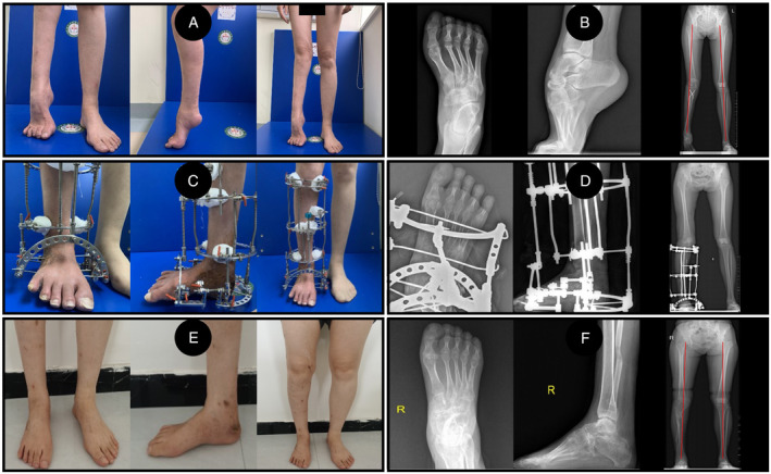 FIGURE 4