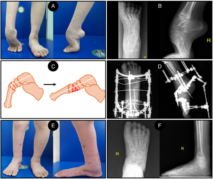 FIGURE 3