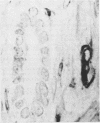 361