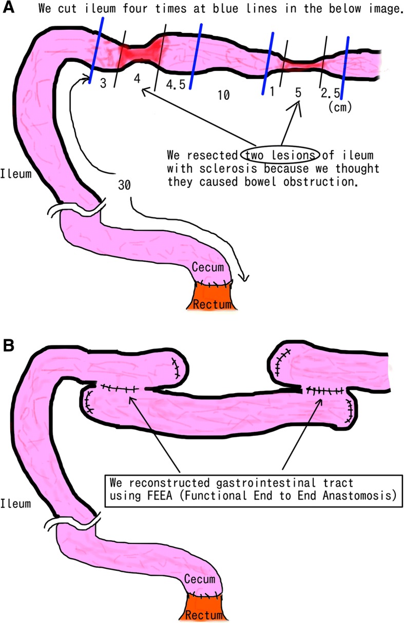 Fig. 3