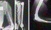 Figure 2 -