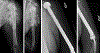 Figure 1 -