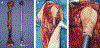 Figure 4 -