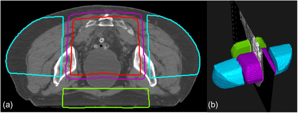 FIGURE 4