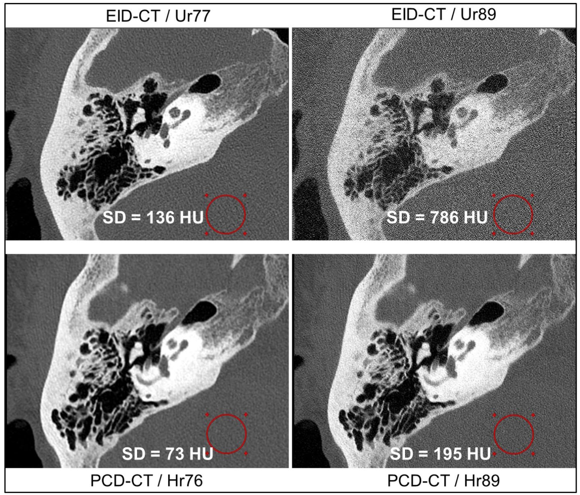 Figure 11: