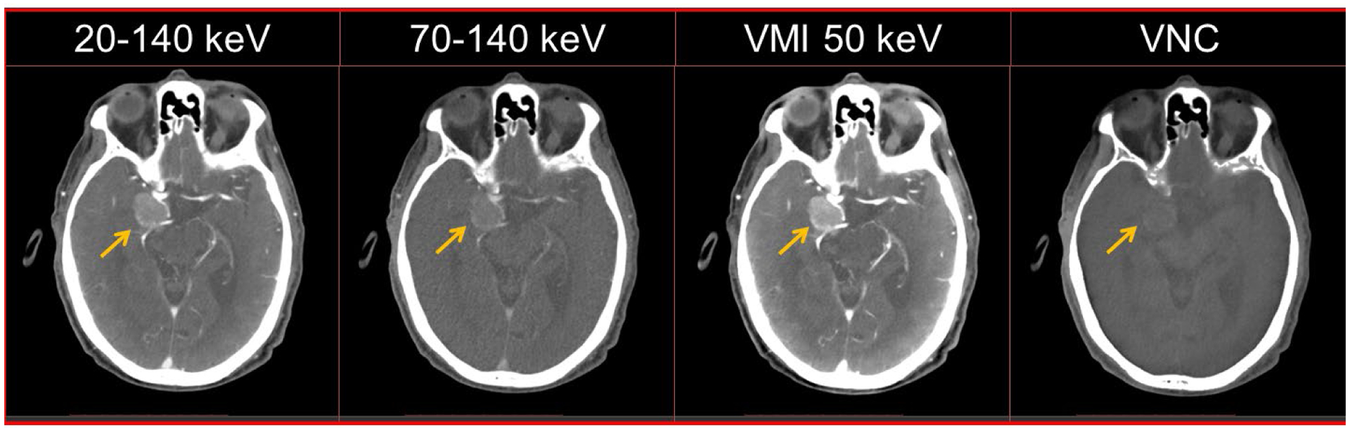 Figure 13: