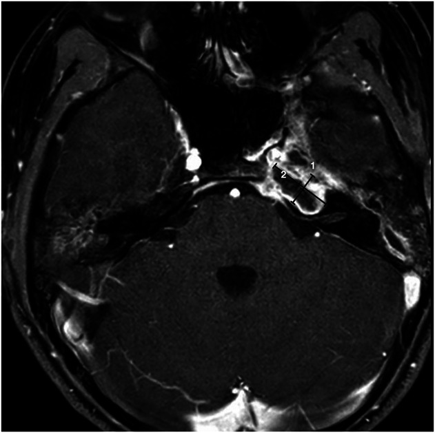 FIG. 1.