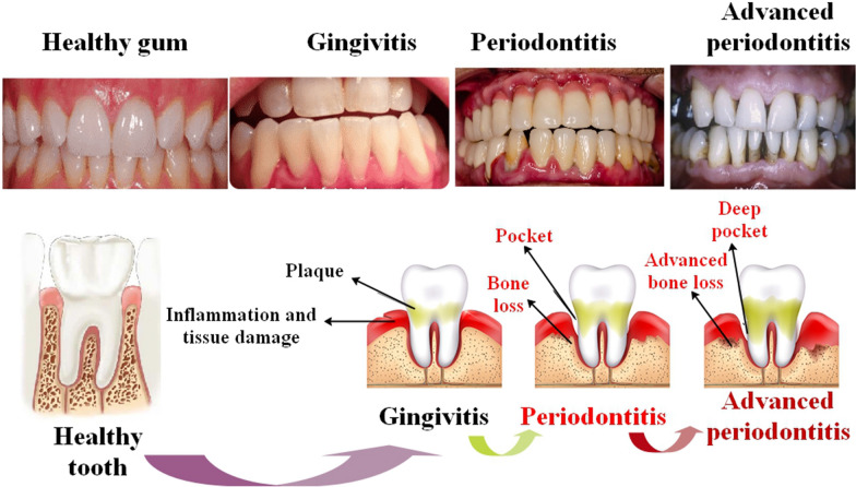 Fig. 1