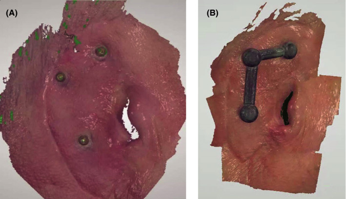 FIGURE 4