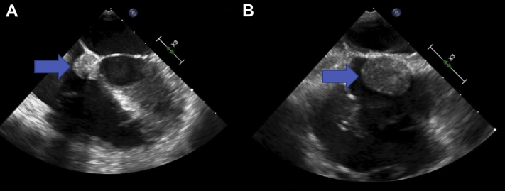 Figure 4