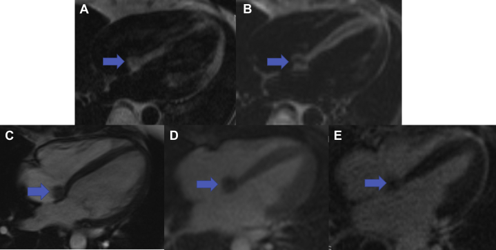 Figure 3