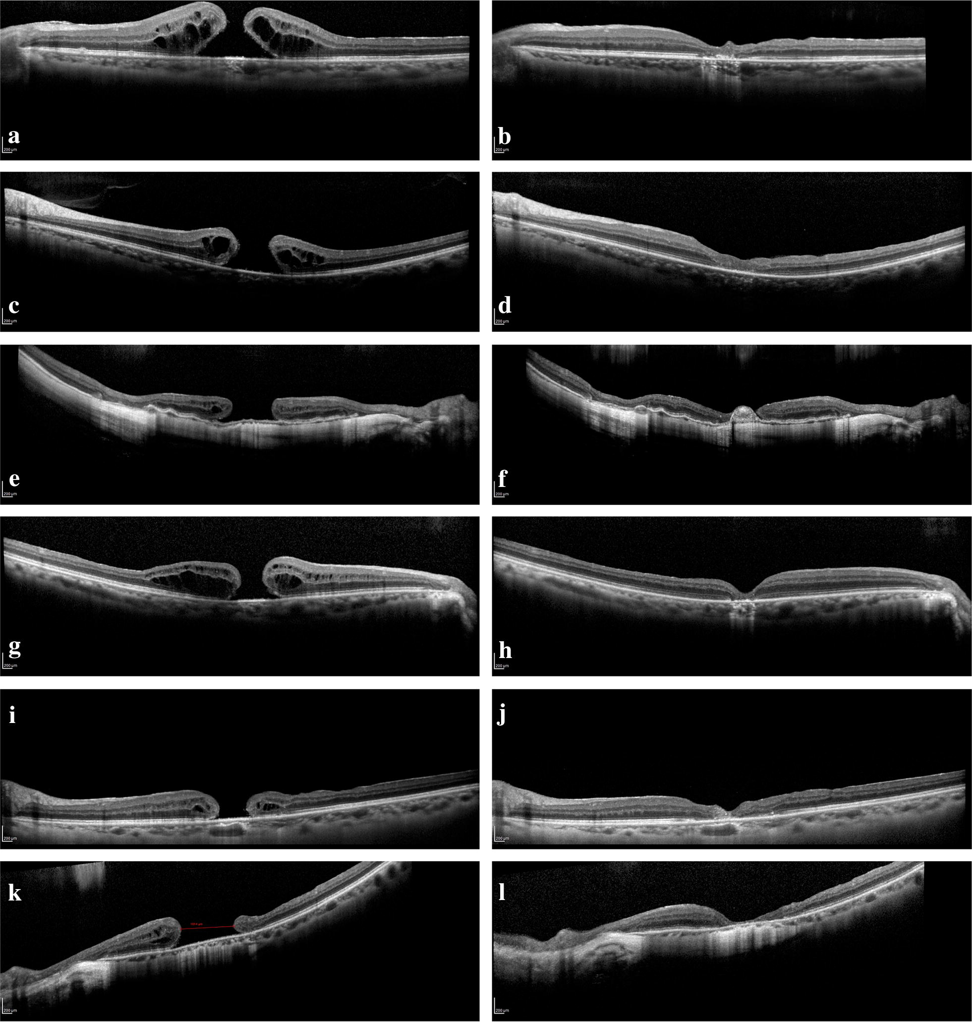 Fig. 1