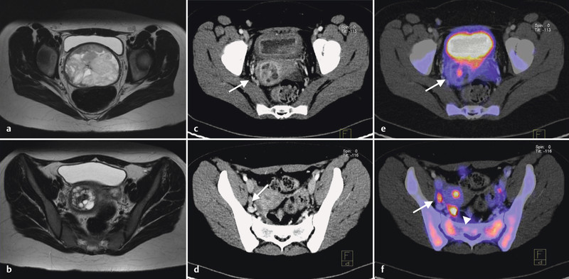 Fig. 2 a