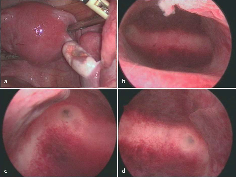 Fig. 3 a