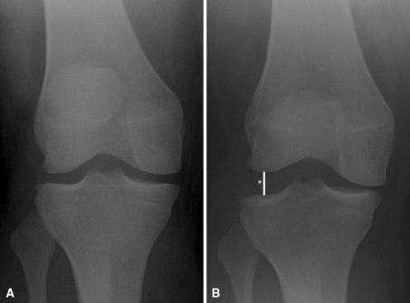 Fig. 1A–B