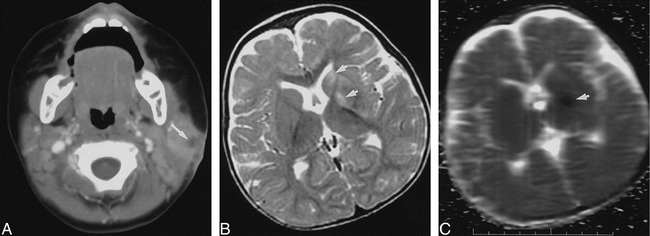 fig 5.