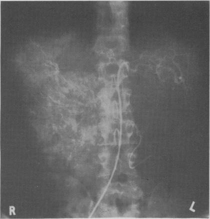 FIG. 2b