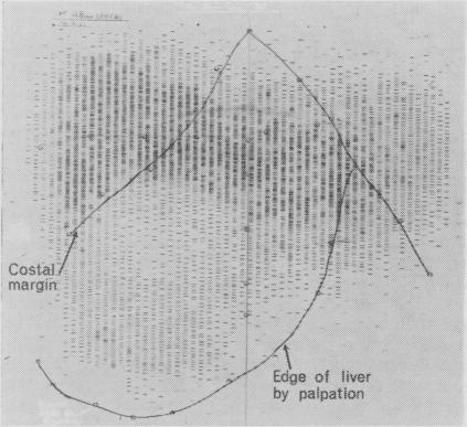 FIG. 1a