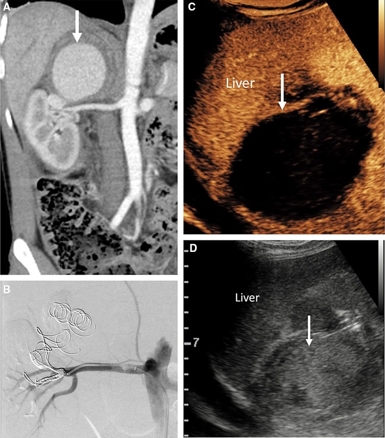 Fig. 10
